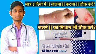 Silverex Ionic Gel मतर 3 दन म जलन कटन जलन क नशन ठक कर Silver Nitrate