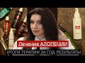 Алопеция не приговор! Мой опыт лечения — делюсь результатами. Что сработало, а что нет. Миноксидил