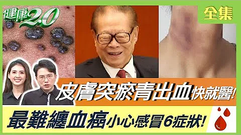 江澤民白血病逝世 疲倦、瘀青出血快就醫！最難纏血癌 小心感冒6症狀！輕碰瘀青恐肝腎出毛病！身上紅痣多是血管瘤！健康2.0 20221218【完整版】江坤俊 韋汝 柳朋馳 吳吉妮 陳潮宗 陳麗華 林秋香 - 天天要聞