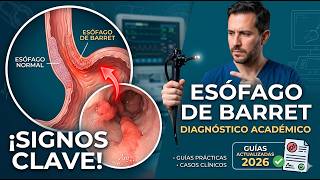 ESOFAGO DE BARRET