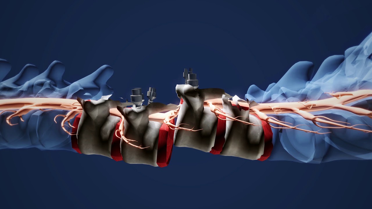 Miraculous Neurosurgical Procedure at Carolinas HealthCare System