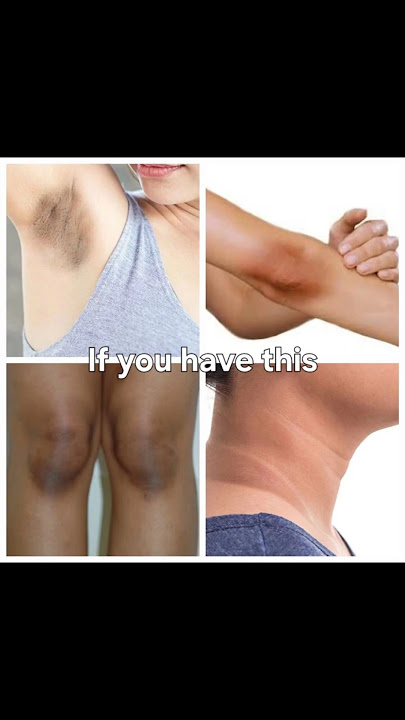 Download lagu POV you find the right way to use Johnson's baby oil 💓 #jhonson #babyoil #beutyproduct