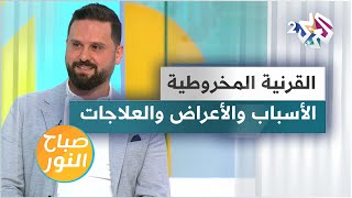 احدث طرق علاج القرنية المخروطية وأسبابها وأعراضها