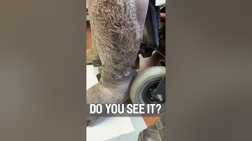 WHAT IS CRAWLING OUT OF THIS LEG?😳🤯 #shorts #information
