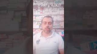 علاج الثعلبة