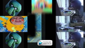 21 Shuric Scans With Are Slides