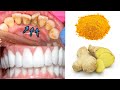 How to clean teeth plaque naturally in 5 minutes with ginger &amp; turmeric powder | Teeth whitening