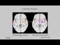 Extraordinary Variations of the Human Mind: James McGaugh: Highly Superior Autobiographical Memory