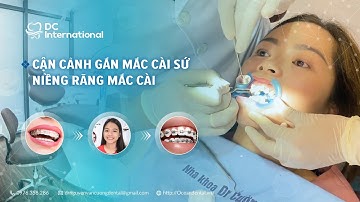 Cận Cảnh Gắn Mắc Cài Sứ! Niềng Răng Mắc Cài Dr Cường