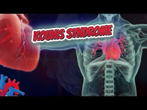 Kounis syndrome - Human Heart and Cardiology ❤️❤️❤️🔊✅