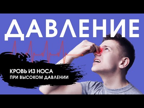 Что делать, когда идет КРОВЬ ИЗ НОСА при высоком давлении?