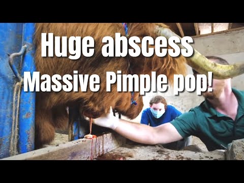 Video: Pimple On The Anus: Příčiny A Léčby