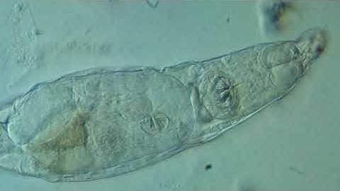 Bdelloid rotifer with another, new rotifer inside