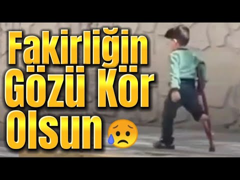 Ayakkabıcı ve Bir Ayağı Olmayan Çocuğun Hikayesi