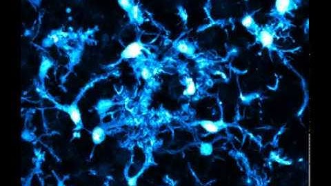 Microglía en movimiento