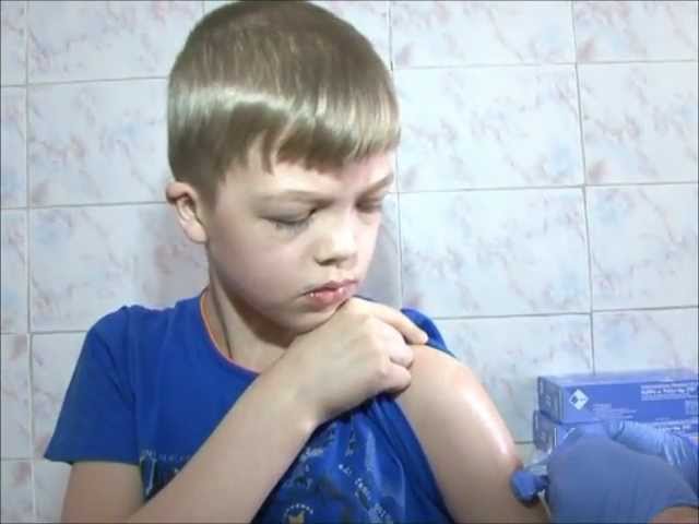Прививки от клещевого энцефалита.wmv
