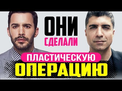 Пластические операции турецких актеров мужчин