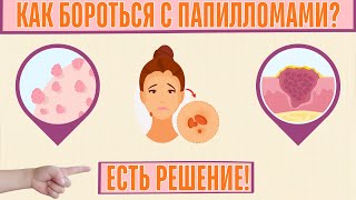 Папилломы уйдут БЕЗ СЛЕДА👀! Вот 5 лучших помощников. Кожа скажет СПАСИБО👨⚕️!