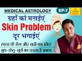 Medical Astrology | जानिए कुंडली मे कौनसे ग्रह देते हैं Skin Problem व उपाय SURESH SHRIMALI | Ep-7