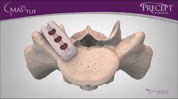MAS™ TLIF with Precept™ Modular