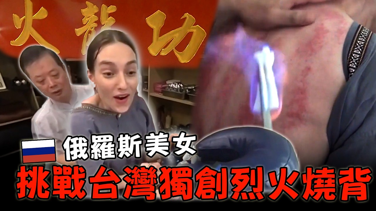 俄羅斯正妹挑戰烈火燒背 全球唯一獨創火療法【外國人在台灣】