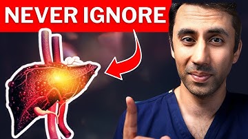 Early Warning Signs of Fatty Liver Disease (You Might Be Ignoring) 🚩