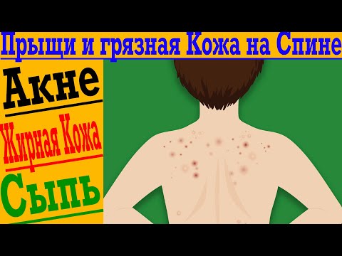 Прыщи и грязная кожа на спине! Как убрать акне, жирную кожу и сыпь?!