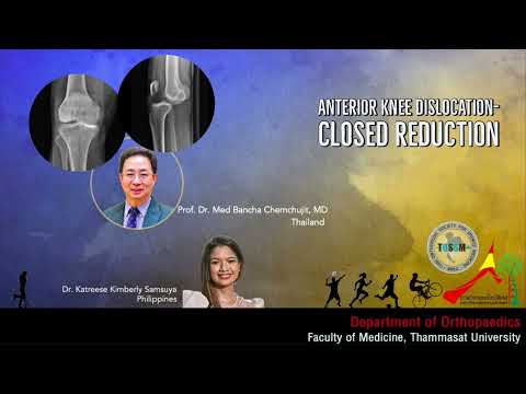 Knee Dislocation Closed Reduction ข้อเข่าหลุดเอ็นเข่าฉีกขาด Dr.Pratchaya, Katreese, Dr.BanchaบัญชาTU