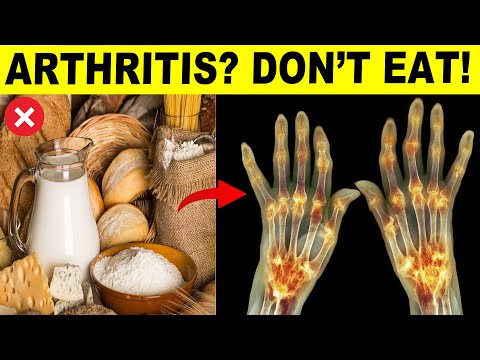 9 Foods To Avoid If You Have Arthritis