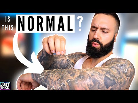 Vídeo: Peeling De Tatuaje: ¿es Normal O Algo Está Mal?