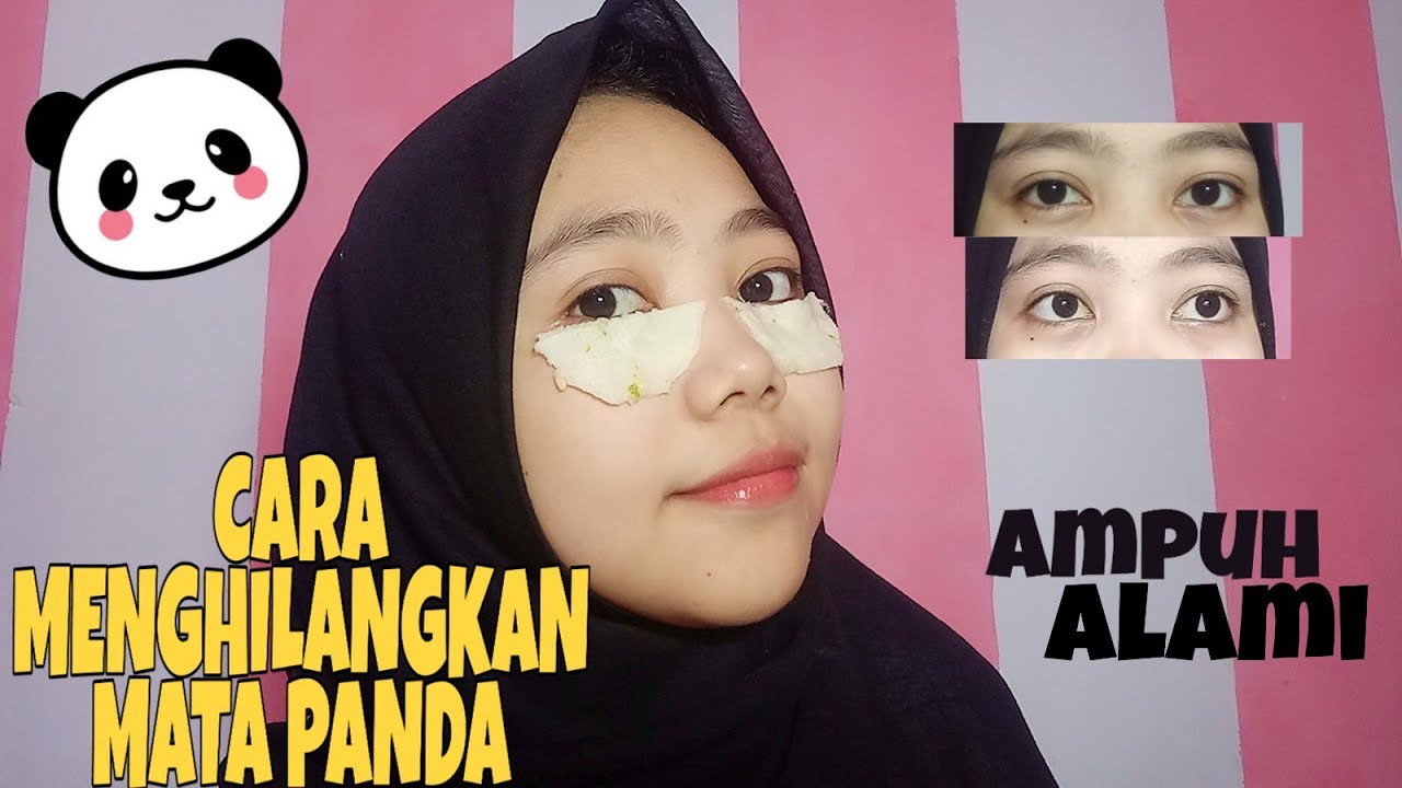 Cara Menghilangkan Kantung Mata Yang Menghitam 