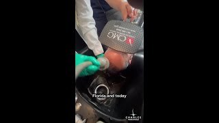 Patient Hair Wash