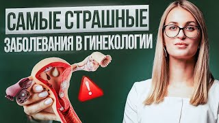 90% не знают ЭТОГО! 5 Гинекологических ДИАГНОЗОВ которые игнорируют