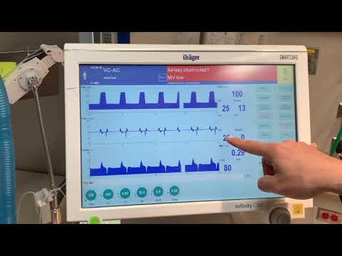 Introduction to a Drager Ventilator