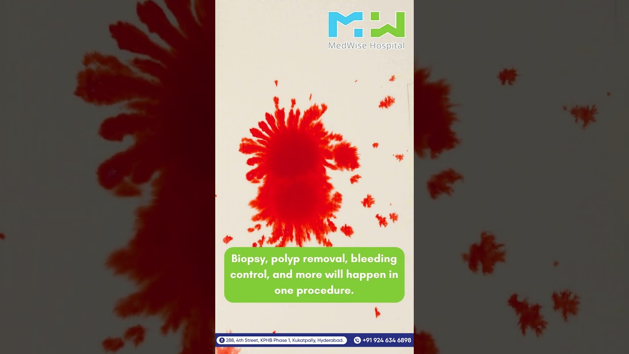 5 Benefits of USG Biopsy | Medwise Hospital | KPHB