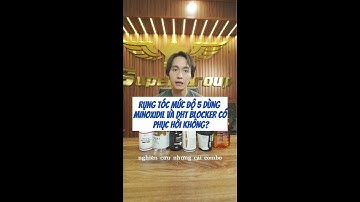 RỤNG TÓC MỨC ĐỘ 5 DÙNG MINOXIDIL VÀ DHT BLOCKER CÓ PHỤC HÒI KHÔNG|Nguyễn Quốc Nam