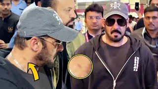 Salman Khan Hickey (Love Bite) On Neck Clearly Visible At Mumbai Airport