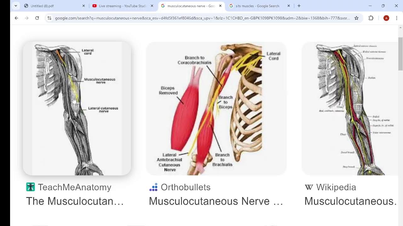 RAFIULLAH(Upper limb)by Dr Ali Atiq