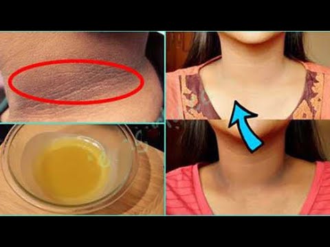 COMO BLANQUEAR LA PIEL OSCURA EL CUELLO DE FORMA NATURAL - YouTube