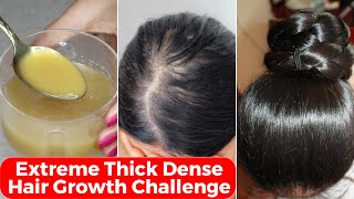 30 Days Extreme Thick Hair Growth Challenge-Increase Hair Density & thickness-पतले बालों को घना करे