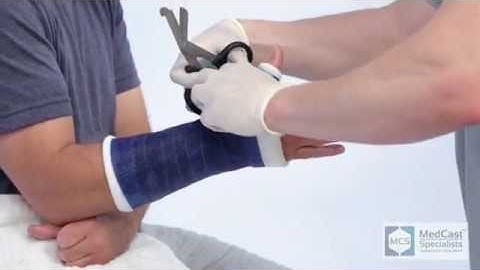 How to apply a Thumb Spica Cast  - Plus Cast Removal