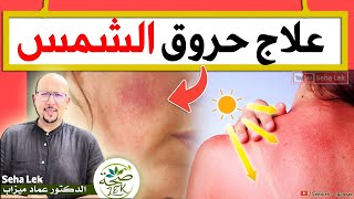 أهم الوصفات الطبيعية لعلاج حروق الشمس / Wasafat Dr imad mizab visage