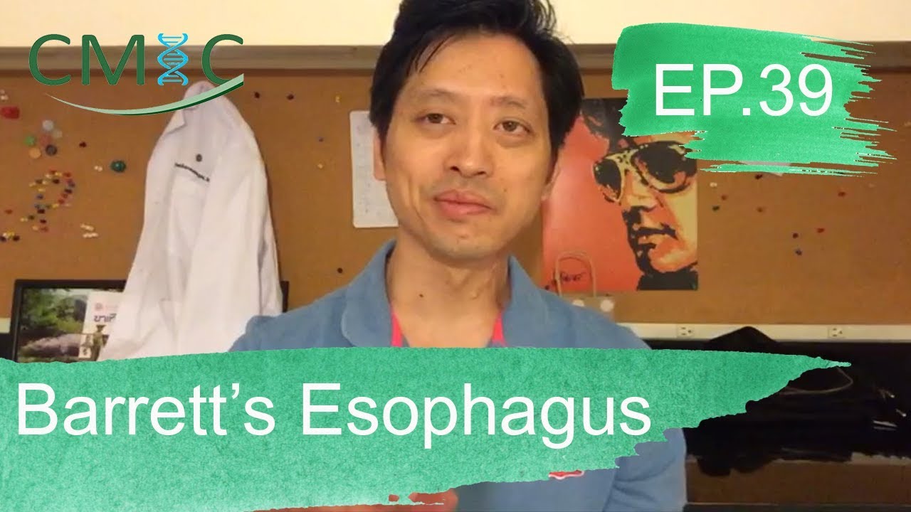 ภาวะแทรกซ้อนของโรคกรดไหลย้อน (Barrett’s Esophagus) โดยนายแพทย์จักรีวัชร