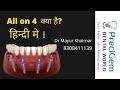 All on 4 dental implants in Mumbai -  Dr Mayur Khairnar - All on 4  क्या है?  हिन्दी मे  | Mumbai