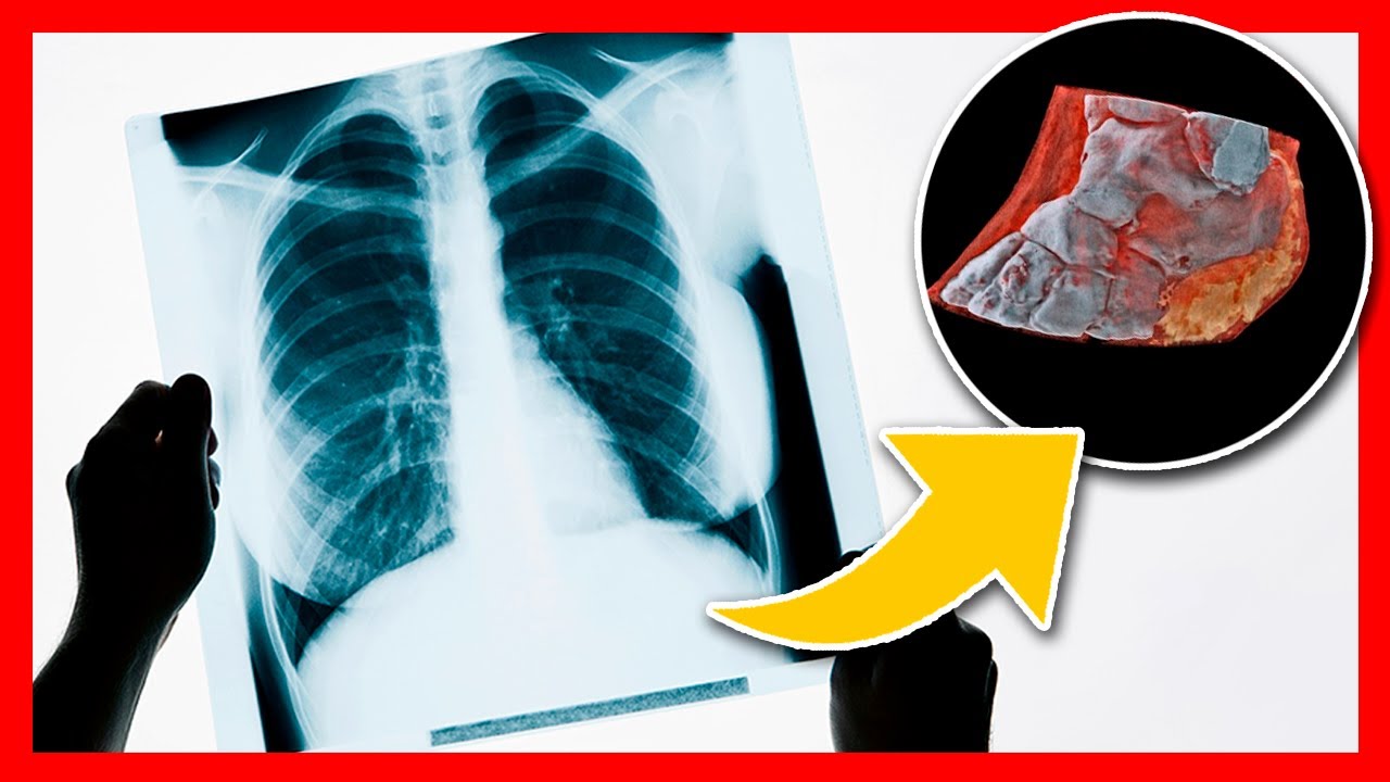 💉 ¿Cómo son las RADIOGRAFÍAS en COLOR y en 3D? - YouTube