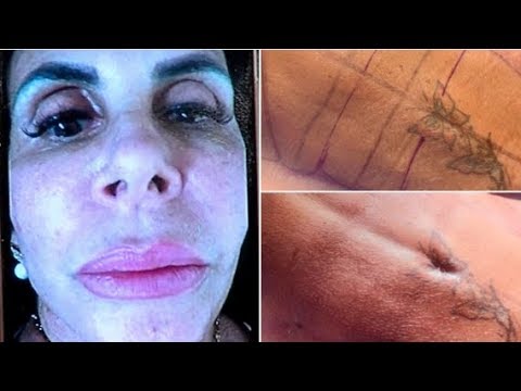 Vídeo: Natalia Podolskaya Sem Maquiagem Falou Sobre A Cirurgia Plástica Realizada