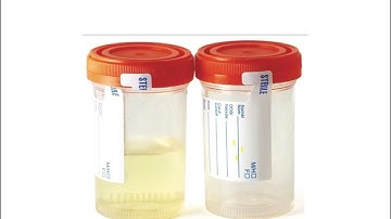 Chapter 16 Urinalysis, Body Fluids, and Other Specimens Lecture