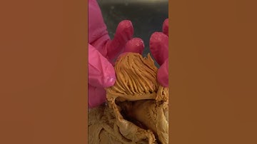 Amazing Muscle Inside a REAL Human Heart