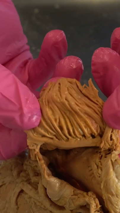 Amazing Muscle Inside a REAL Human Heart