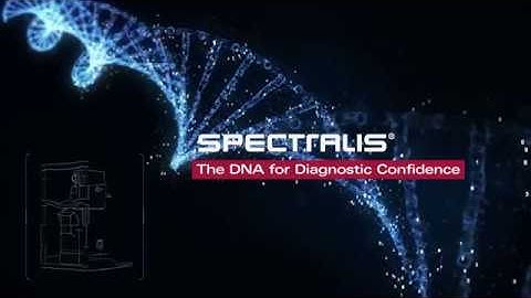 Noise Reduction | SPECTRALIS